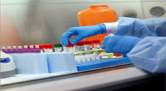 Syngene International opens COVID-19 RT-PCR testing centre