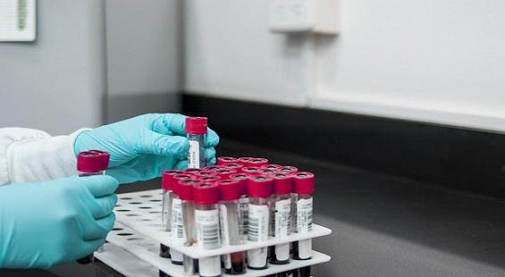 Cadila to manufacture ELISA antibody test kits