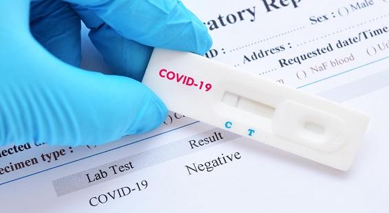 Syngene and HiMedia Labs join hands to develop COVID-19 test kits