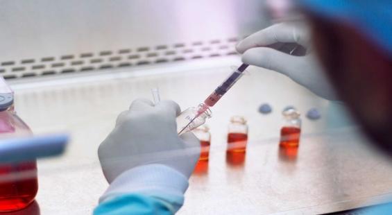 Hester Biosciences acquires tech to develop Brucella vaccine from IVRI