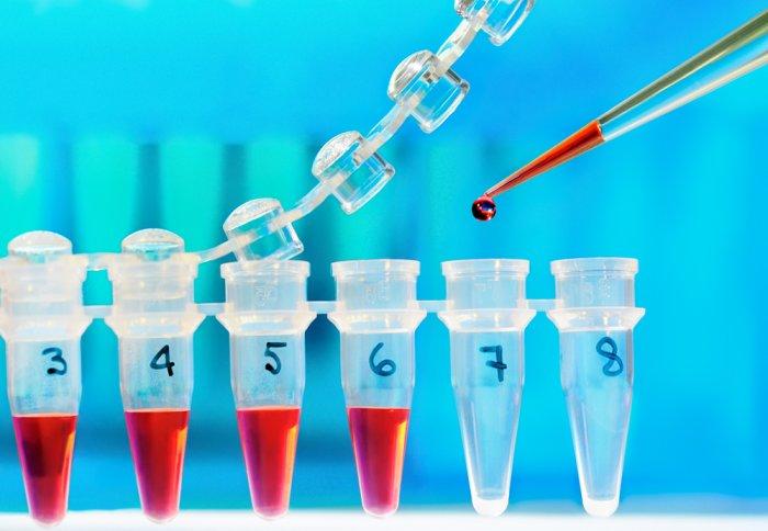 IPO Analysis: Thyrocare Technologies